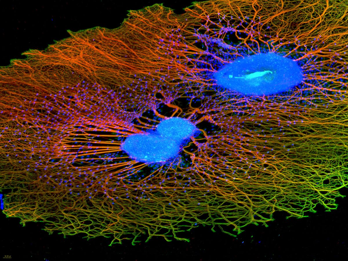 zur Vergrößerungsansicht des Bildes: Dorsale Wurzelganglien (blau), aus denen Nervenfasern (rot) und Versorgungsstrukturen (grün) auswachsen