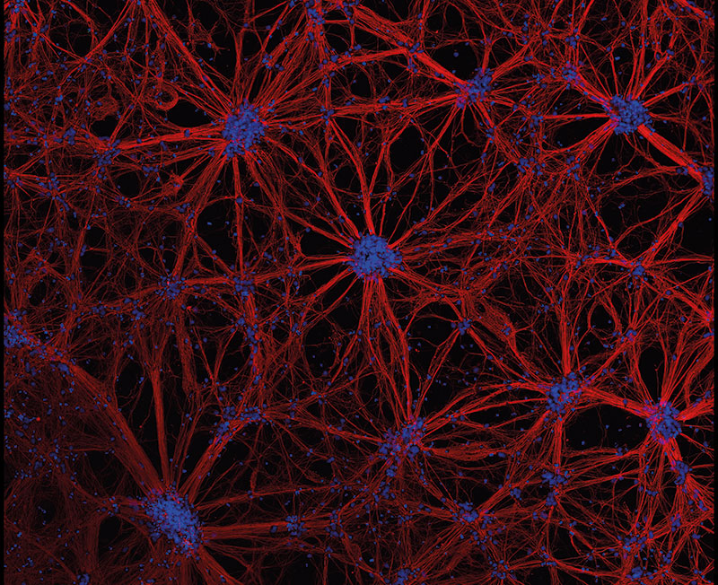 zur Vergrößerungsansicht des Bildes: Neuronale Netzwerke, differenziert aus humanen neuronalen Vorläuferzellen (konfokale Laserrastermikroskop-Aufnahme)