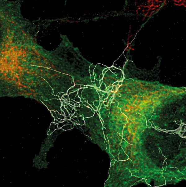 High-resolution confocal laser scanning microscope image of neurotoxic beta-Amyloyd fibrils on neuronal cells.