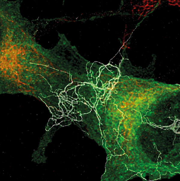 Hochaufgelöste konfokale Laserrastermikroskop-Aufnahme von neurotoxischen beta-Amyloyd Fibrillen auf neuronalen Zellen. Foto: Universität Leipzig, BBZ, Molekularbiologisch-biochemische Prozesstechnik zur Vergrößerungsansicht des Bildes: Hochaufgelöste konfokale Laserrastermikroskop-Aufnahme von neurotoxischen beta-Amyloyd Fibrillen auf neuronalen Zellen