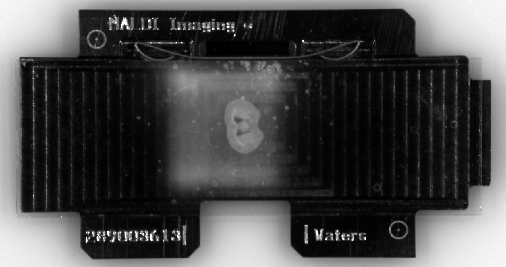 zur Vergrößerungsansicht des Bildes: Gewebeschnitt eines Mausgehirns auf Träger für MALDI Imaging