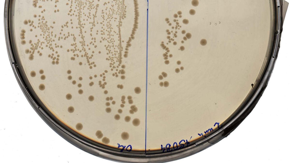 zur Vergrößerungsansicht des Bildes: Agarplatte mit E. coli Bakterienkolonien