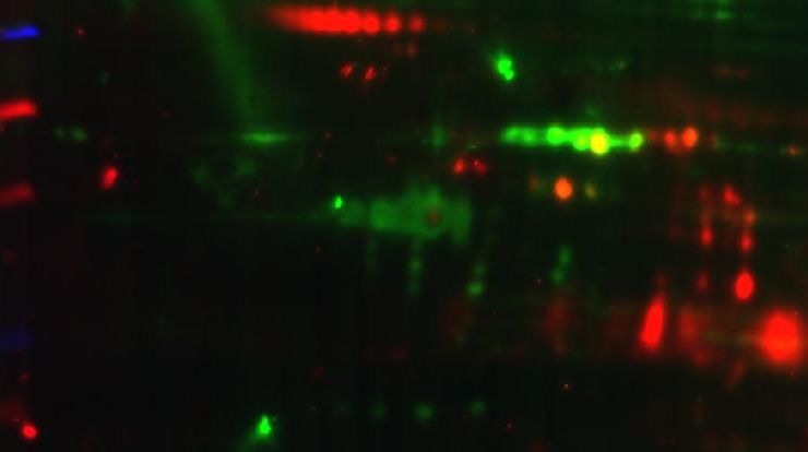 Überlagernde Darstellung eines 2D-Immunoblots in rot mit einer 2D-Gelelektrophorese in grün, Foto: Universität Leipzig, BBZ, Bioanalytik