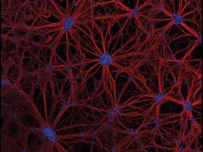 Neuronale Netzwerke, differenziert aus humanen neuronalen Vorläuferzellen (konfokale Laserrastermikroskop-Aufnahme)