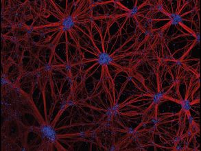 Neuronale Netzwerke, differenziert aus humanen neuronalen Vorläuferzellen (konfokale Laserrastermikroskop-Aufnahme)