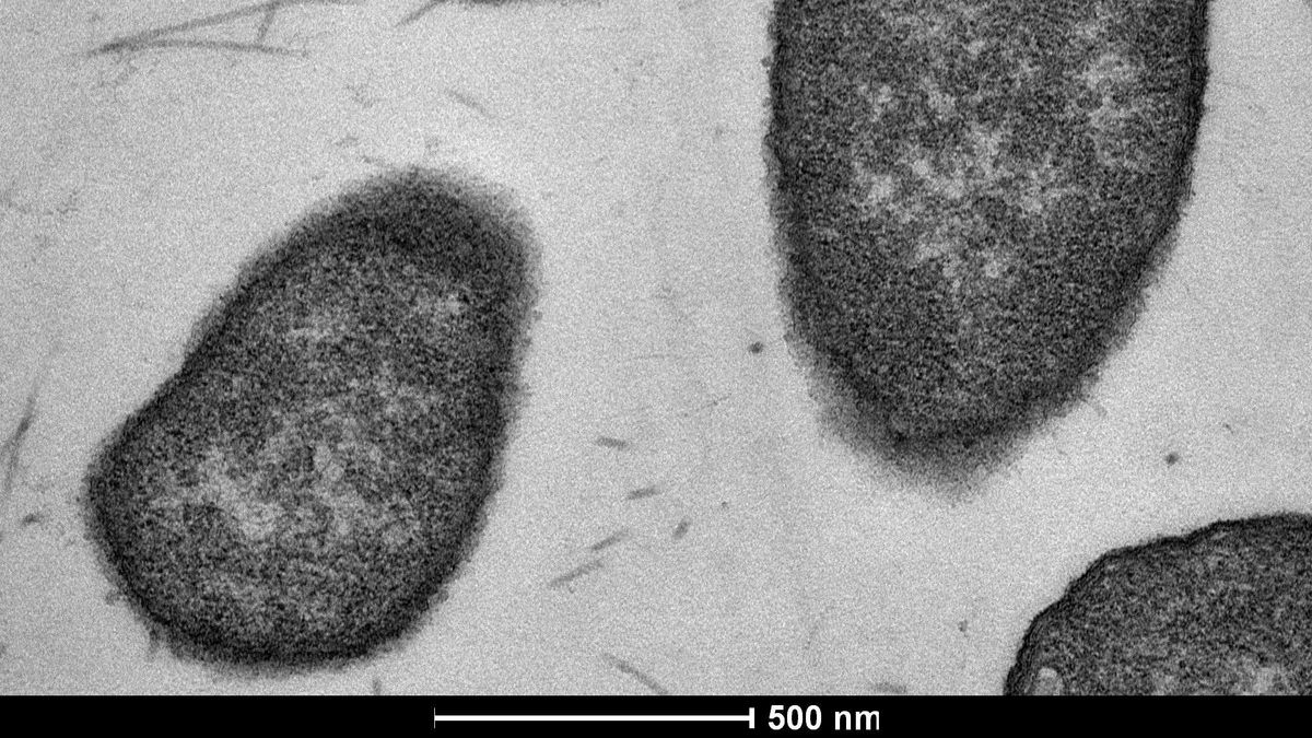 enlarge the image: Elektronenmikroskopie Aufnahme von 3 Escherichia coli Zellen nach Behandlung mit antimikrobiellen Peptid Api137