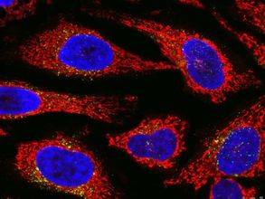 Mikroskop-Aufnahme von Hela-Zellen mit Zellkernen in blau, Zytosol in rot und antimikrobielles Peptid Api137 in grün
