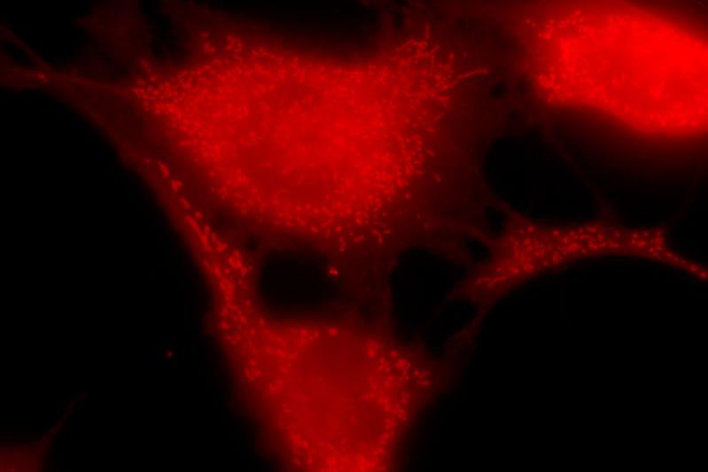 zur Vergrößerungsansicht des Bildes: Fluoreszenzaufnahme von Mitochondrien